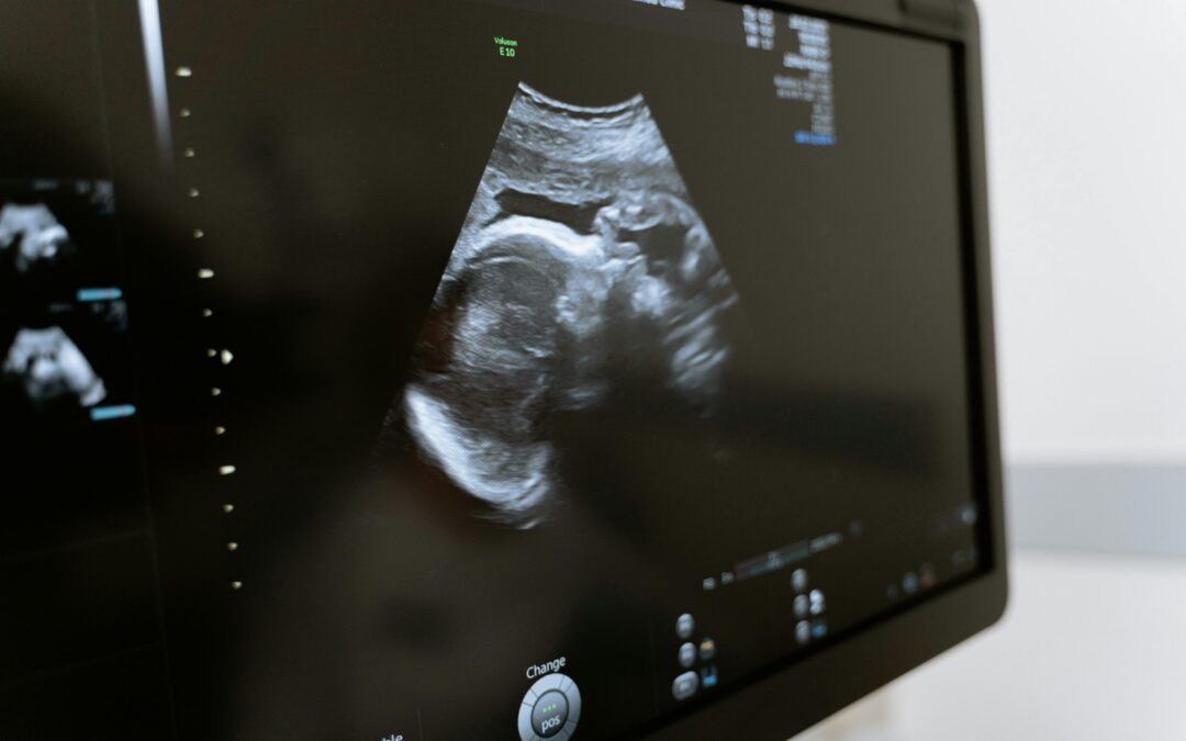 8,000 Lives Saved by Abortion Pill Rescue Network