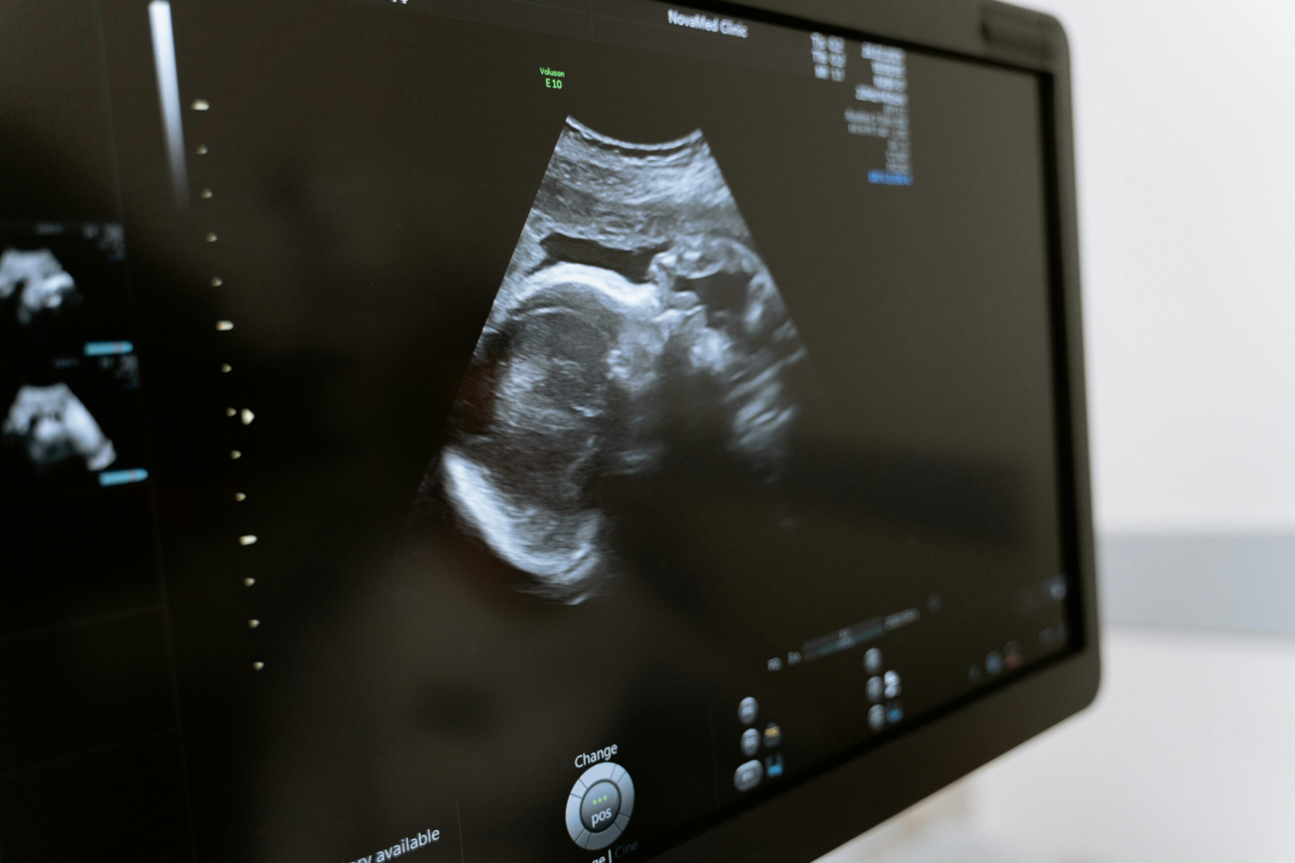 8,000 Lives Saved by Abortion Pill Rescue Network