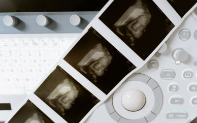 Ultrasound printouts laid across an ultrasound machine with control knobs and a keyboard visible in the background